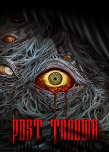Pochette Post Trauma version Xbox Series X/S